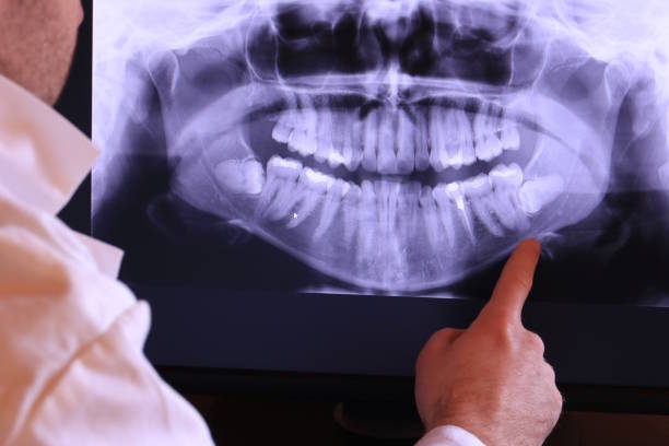 Best Emergency TMJ Treatment in Blissfield, MI